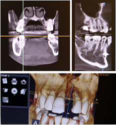 歯科用ＣＴ外来