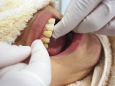 Q.歯周病にかかった人の特別なコースはありますか。