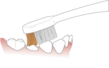歯の磨き方