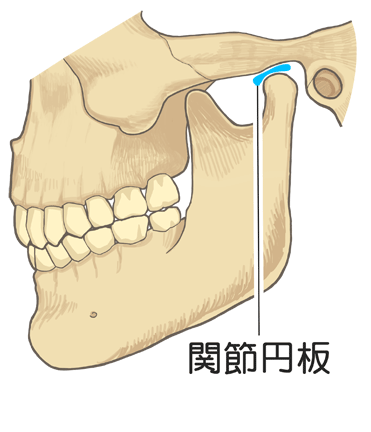 マニピュレーション療法