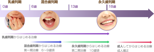 矯正治療を開始する目安について