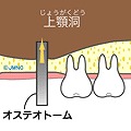 ソケットリフト