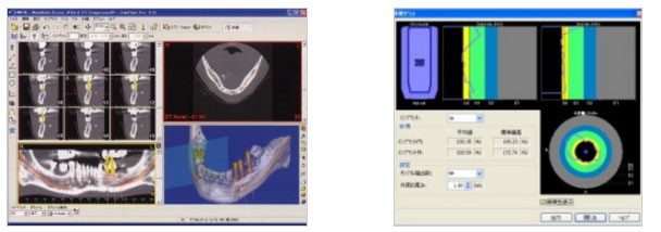 当院のインプラント治療の特徴